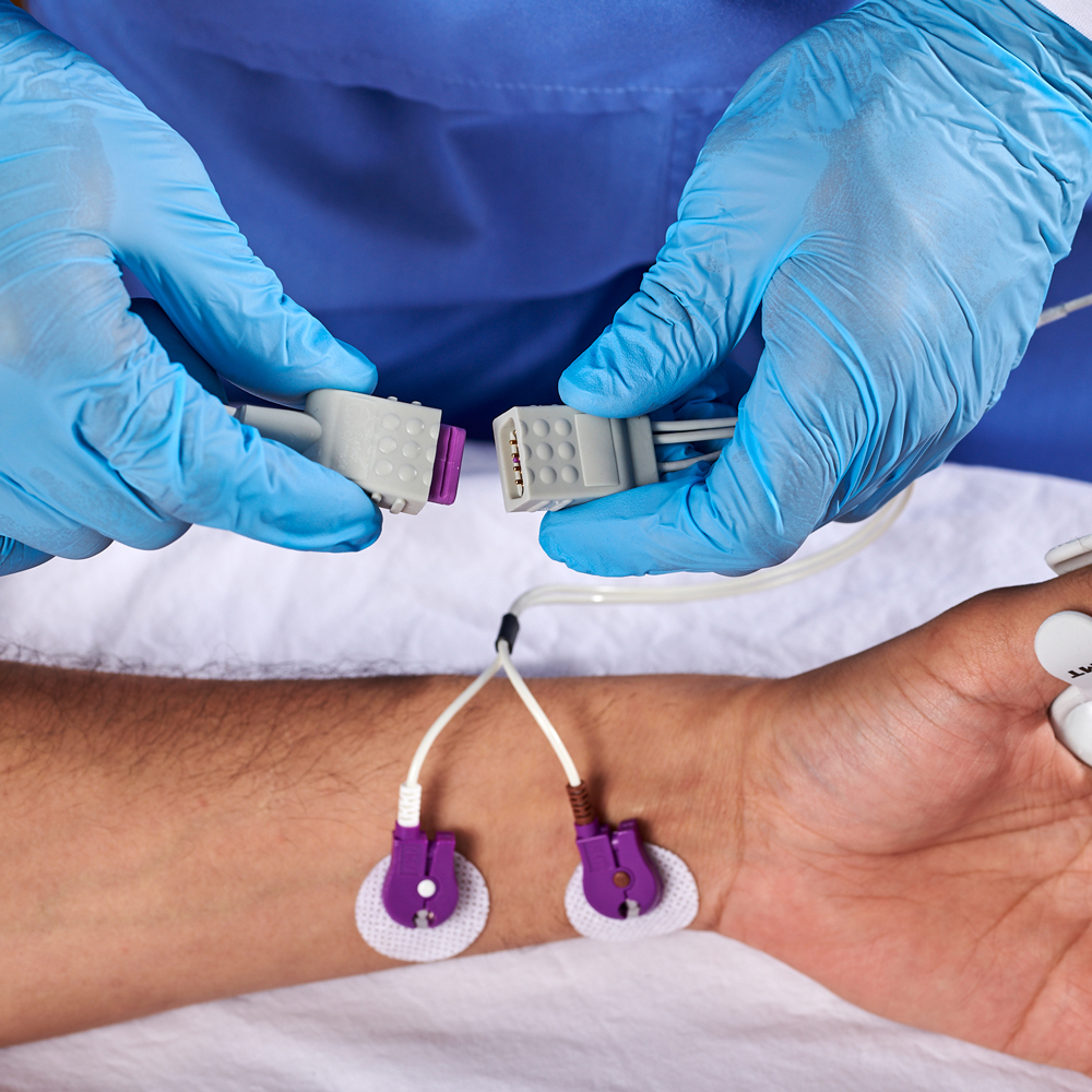 CABLE DE SENSOR NMT, 3.3 M/11 PIES CABLE DE SENSOR NMT, 3.3 M/11 PIES